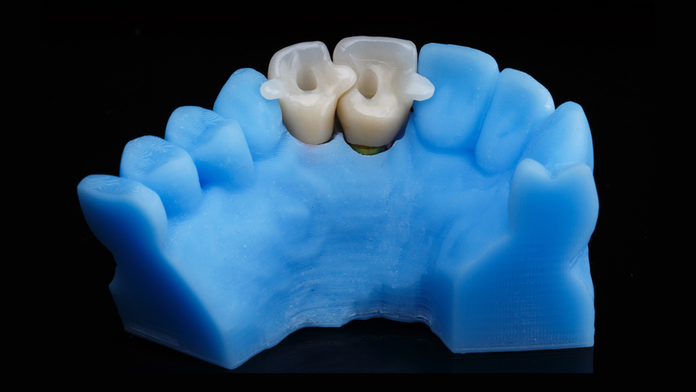falls-dental-lab-inc_Service_3d-printing