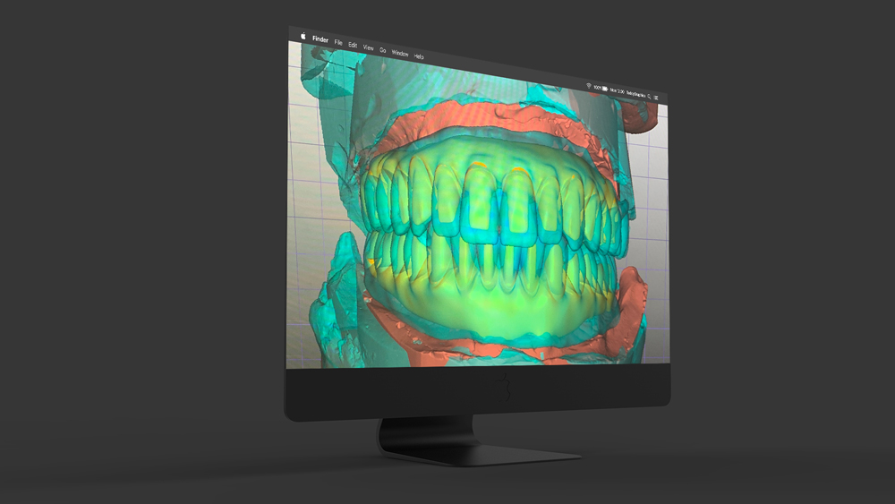 falls-dental-lab-inc_Service_case-planning
